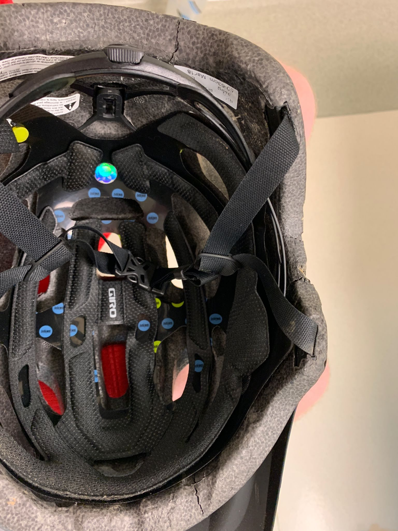 Cracks at right forehead, right ear, and back of head. I recently upgraded to a helmet that covers the lower back part of my skull from a more road/XC style lid (good call).
